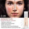 Skinception Rosacea Relief Serum 1 oz - 2 Bottles freeshipping - Natural Health Store